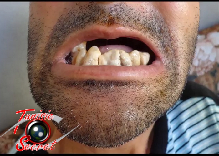 Cancer Tunisie 4 Cancer Tunisie 4